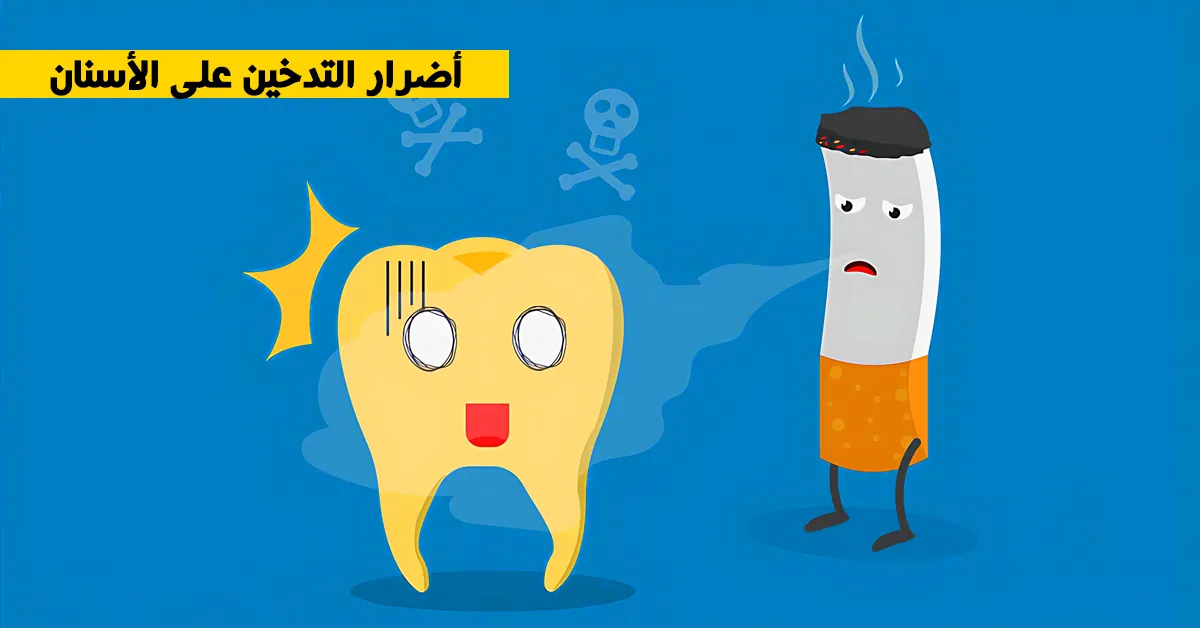 أضرار التدخين على الأسنان